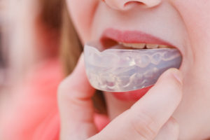 TC-dental-group-custom-mouth-gurad-portection
