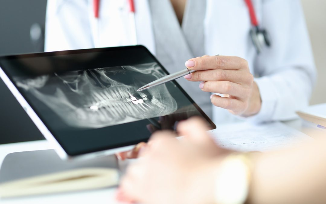 Why are Dental X-rays so important to assess your oral health?