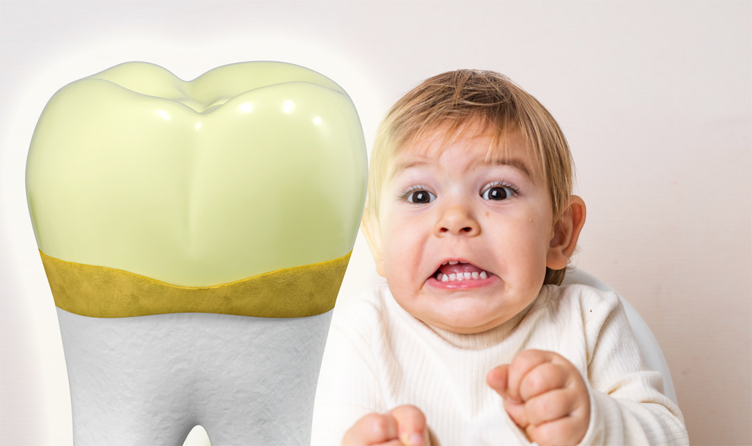 Why plaque removal is essential oral care for children (1-6 years)
