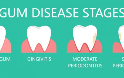How is periodontal disease treated by your dentist?