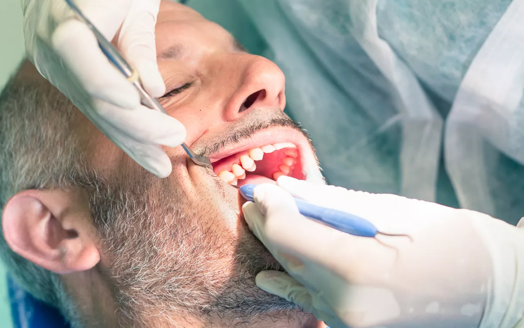 Tc Dental Group wisdom teeth extraction