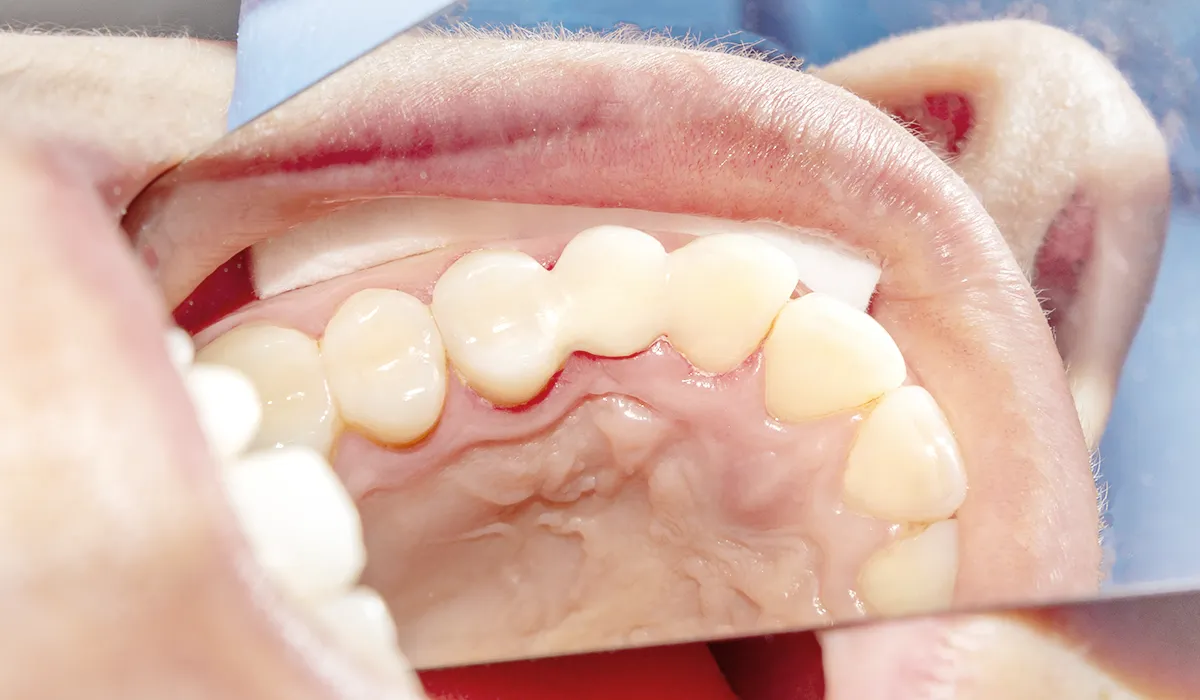 conservative dentistry