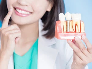 Dental Implants