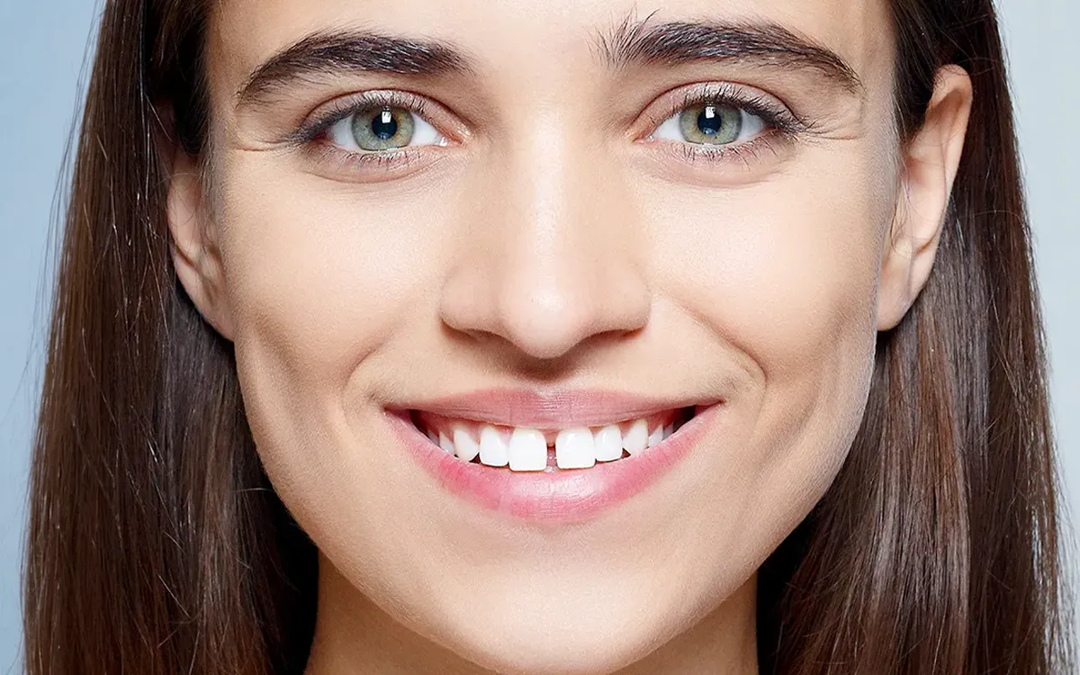 Gaps and spacing