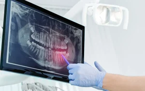 Digital X-rays