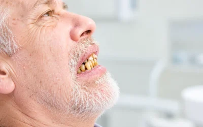 What to do if you haven’t been to the dentist in years